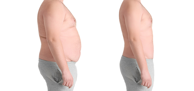 Liposuction-new.jpg